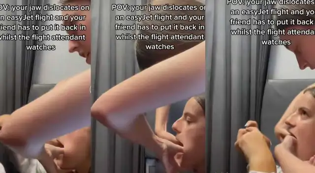 Viral: Joven bostezó y se le salió la mandíbula en medio de un vuelo Viral: Joven bostezó y se le salió la mandíbula en medio de un vuelo