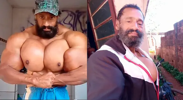 Falleció el 'Hulk brasileño', el fisicoculturista que se inyectaba aceite a los músculos Falleció el 'Hulk brasileño', el fisicoculturista que se inyectaba aceite a los músculos