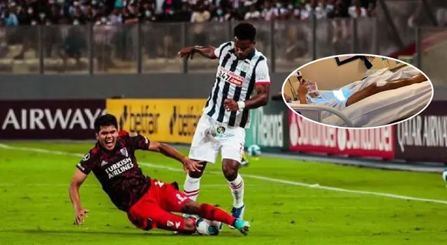 Robert Rojas fue intervenido nuevamente quirúrgicamente