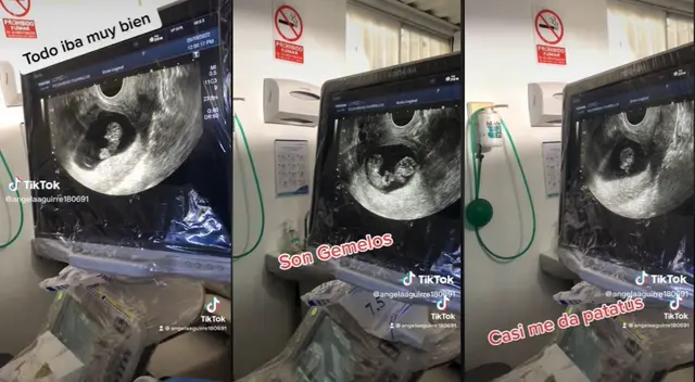TikTok: Se entera que va a ser madre de gemelos y se reacción se vuelve viral.