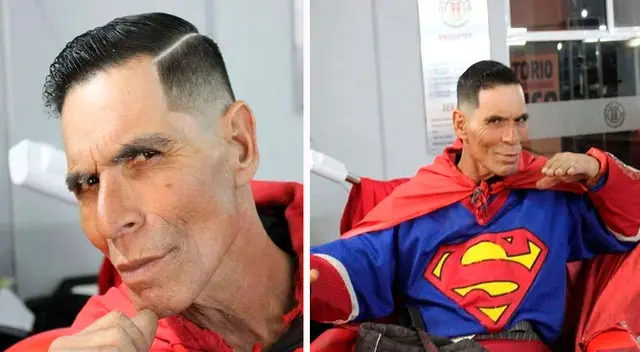 resultado cambio de look Superman chihuahuense