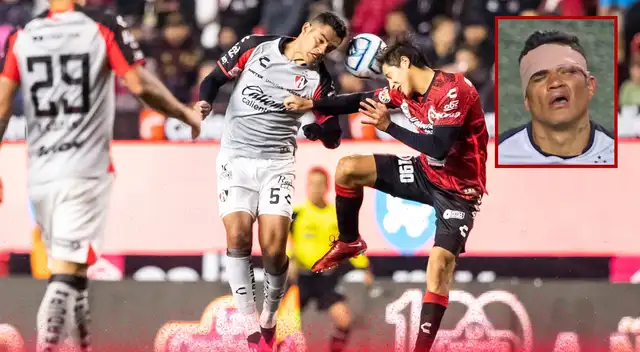 Anderson Santamaría recibió un duro golpe en el rostro.