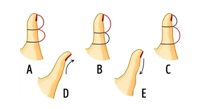 Mira la imagen con atención y elige la alternativa que más se parezca a tu dedo.