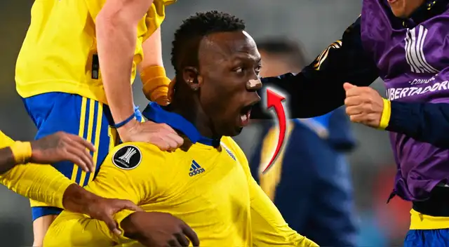 La compleja razón por la que Luis Advíncula juega con una cinta en su nariz.