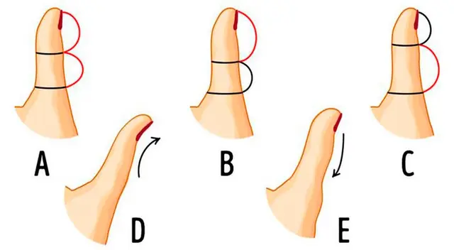 La forma que tiene tu dedo pulgar te ayudará a descubrir más sobre ti. La forma que tiene tu dedo pulgar te ayudará a descubrir más sobre ti.