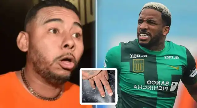 Abel Lobatón defendió al exfutbolista tras ser criticado por sus uñas.