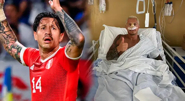Gianluca Lapadula se sometió a nueva operación de nariz