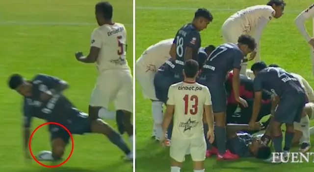 Paolo Reyna sufrió terrible lesión y salió lesionado del Melgar vs. UTC
