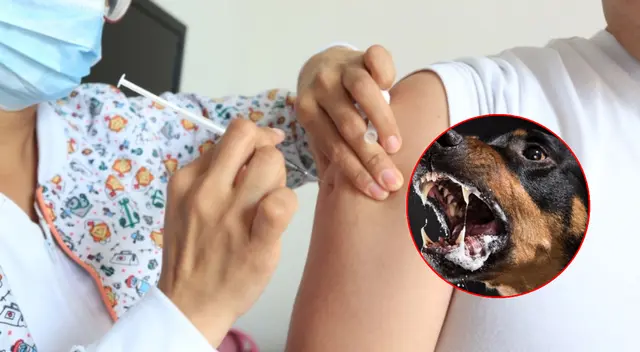 Conoce cuáles son los síntomas y cómo prevenir la rabia humana, según los expertos.