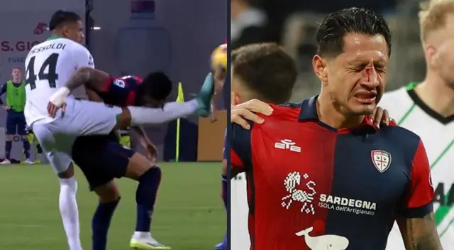 Gianluca Lapadula fue golpeado en la cara durante partido con Cagliari.