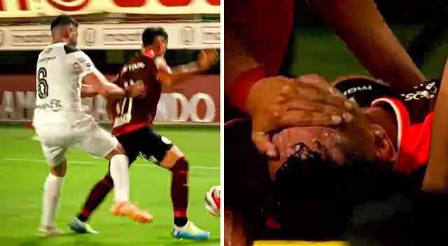 Rivera fue duramente golpeado, pero regresó al terreno de juego.