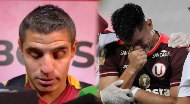 Aldo Corzo se refirió a la lesión de José Rivera. Aldo Corzo se refirió a la lesión de José Rivera.