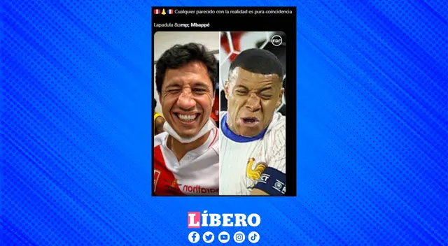 Lesiones similares, ahora le tocará usar una máscara a Mbappé. Lesiones similares, ahora le tocará usar una máscara a Mbappé.