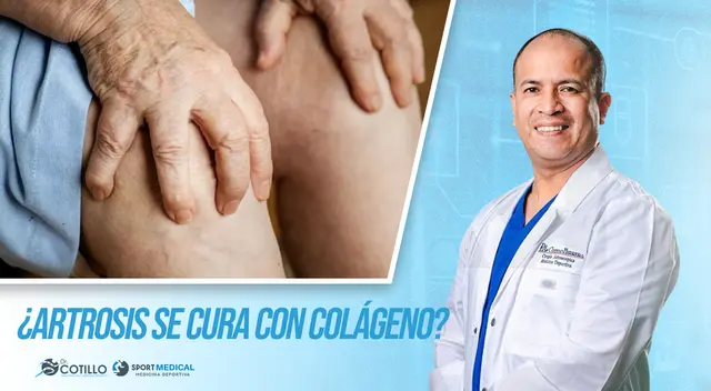 ¿Tienes artrosis y te dijeron que con colágeno te vas a curar? ¿Tienes artrosis y te dijeron que con colágeno te vas a curar?