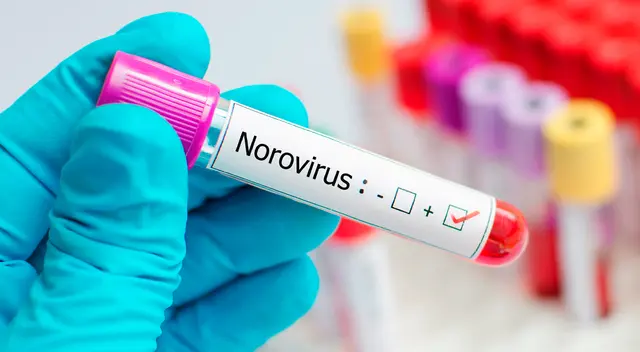 El norovirus, que causa vómitos y diarrea, es responsable del 58% de las infecciones alimentarias en el país.