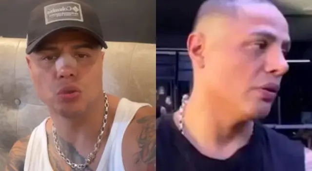 Jonathan Maicelo hace frente a burlas sobre su nariz recién operada Jonathan Maicelo hace frente a burlas sobre su nariz recién operada