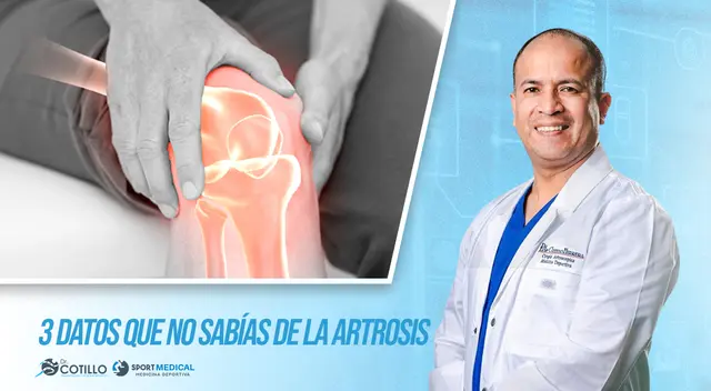 3 cosas que no sabías de la artrosis, por el Dr. Luis Cotillo 3 cosas que no sabías de la artrosis, por el Dr. Luis Cotillo
