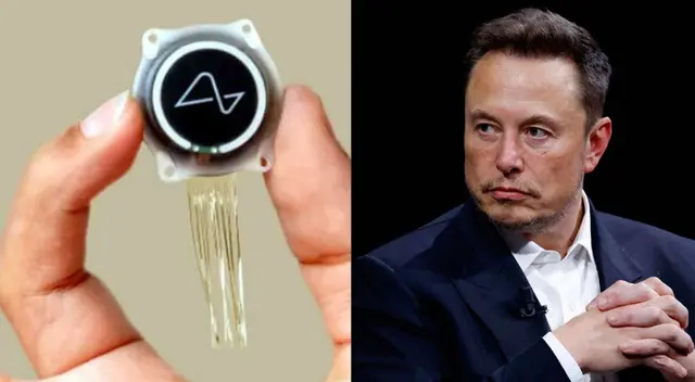 Implante cerebral Elon Musk