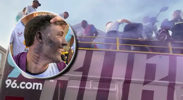 Una bengala cayó en la cara de Oliver Sonne durante las celebraciones de Burnley.