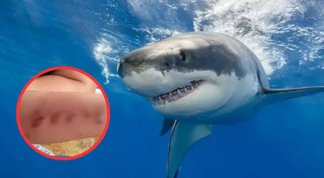 Florida encabeza la lista de ataques de tiburón en Estados Unidos Florida encabeza la lista de ataques de tiburón en Estados Unidos