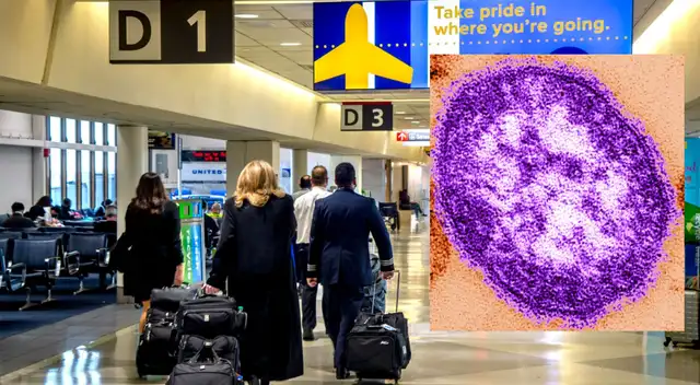 Este virus es uno de lo más contagiosos en todo el mundo.