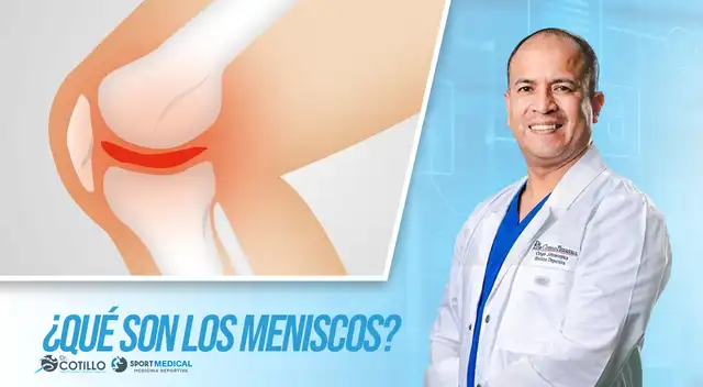 ¿Qué son los meniscos?, por el Dr. Luis Cotillo