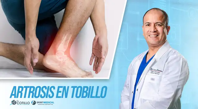 ¿Existe artrosis en otras articulaciones aparte de la rodilla?, por el Dr. Cotillo