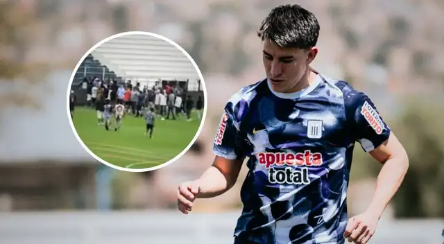 Así se ve el rostro de Fernando Gaibor tras supuesta agresión de barristas de Alianza Lima