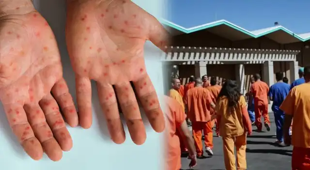 Detectan casos de sarampión en el centro de detención de Dilley, Texas.