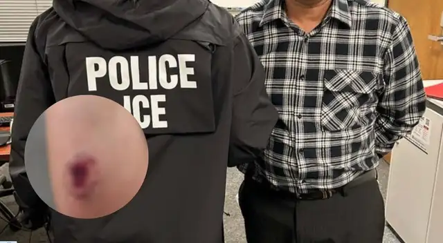 Inmigrante venezolano ilegal fue condenado por morder a un agente del ICE.