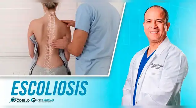 Escoliosis doctor Luis Cotillo Escoliosis doctor Luis Cotillo