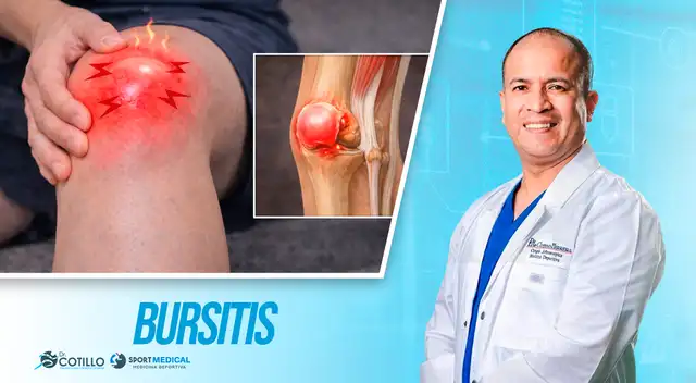Bursitis