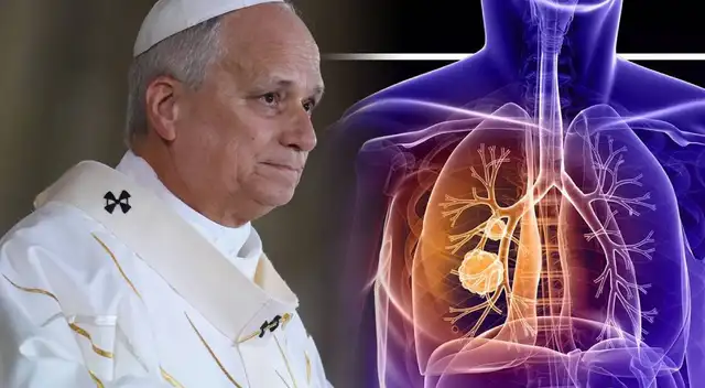 El Vaticano confirma que el papa León XIV padece cáncer pulmonar tras ser operado. El Vaticano confirma que el papa León XIV padece cáncer pulmonar tras ser operado.