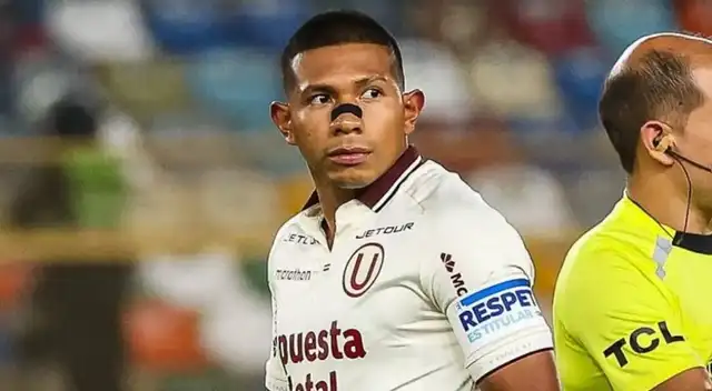 Edison Flores dio dura autocrítica pese a goleada de la 'U' sobre Juan Pablo II