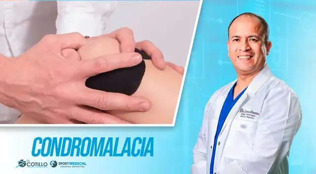 Condromalacia