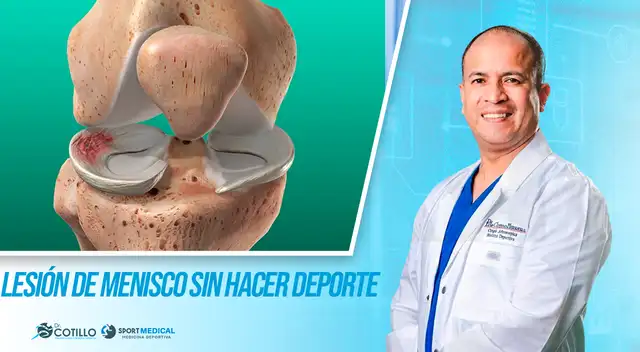 Lesión de menisco sin hacer deporte