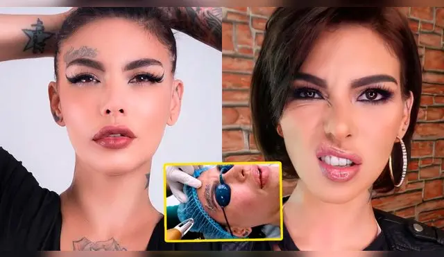 La controversial modelo decidió borrar todos sus tatuajes.