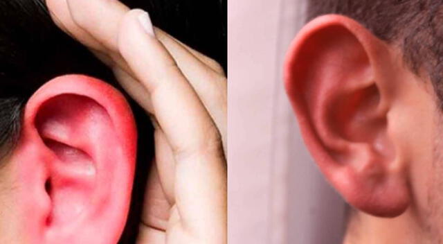¿Mito o verdad?: Cuando te arden las orejas, ¿están hablando mal de ti?