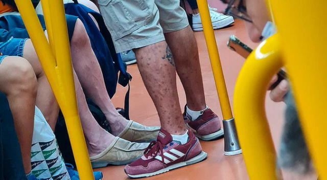 Madrid: Hombre con viruela del mono se subió al metro y alarmó a todos los pasajeros