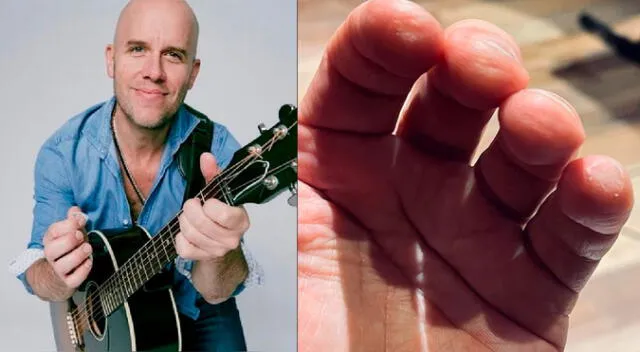 Gian Marco mostró cómo quedaron sus manos tras tocar guitarra Gian Marco mostró cómo quedaron sus manos tras tocar guitarra