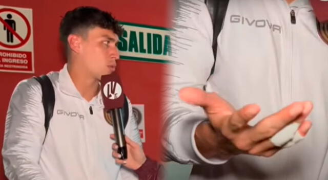 Futbolista venezolano mostró cómo terminaron sus dedos tras enfrentamiento con la Policía