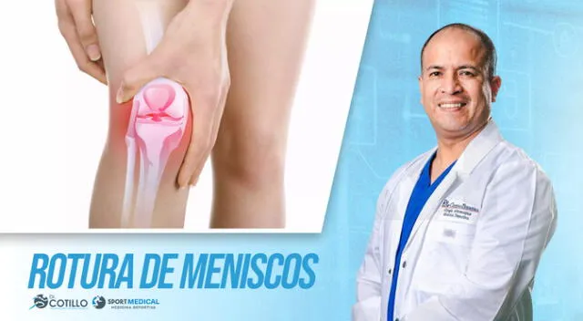 ¿Cuál es el examen para saber si me rompí los meniscos?, por el Dr. Luis Cotillo