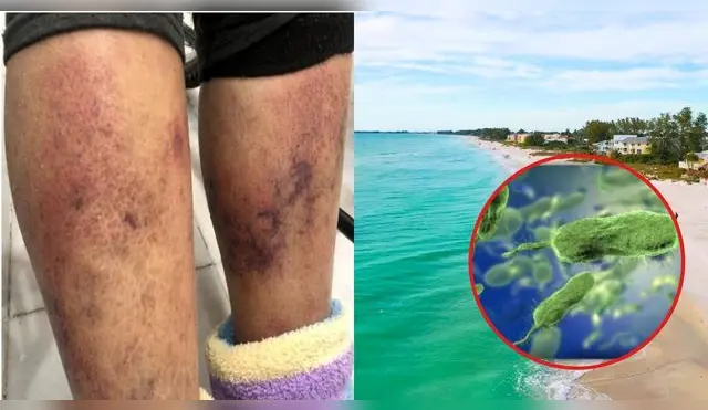 Peligrosa y mortal bacteria se hace presente en las aguas de Florida.