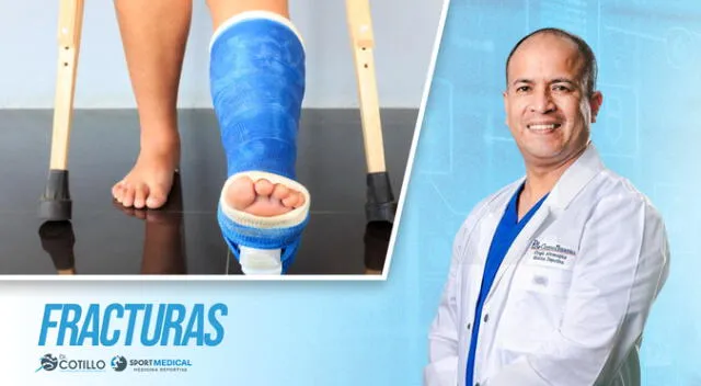 ¿Cuánto tiempo demorarás en recuperarte luego de una fractura?