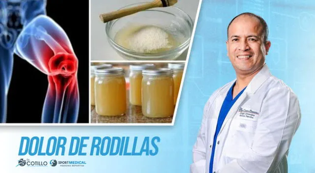 Patita de pollo y gelatina: el mito que no cura el dolor de rodilla, por el Dr. Cotillo