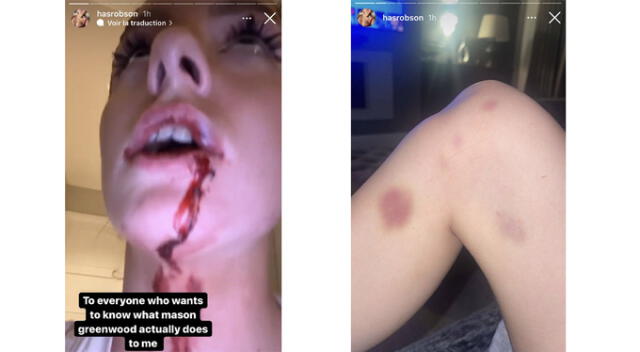  Pareja de Mason Greenwood compartió impactantes imágenes.   