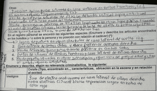 Necropsia de Muñequita Sally