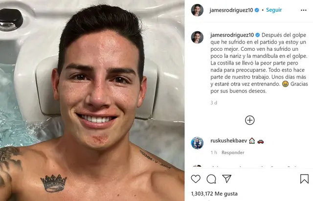 James Rodriguez James Rodriguez