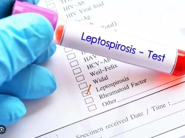 Leptospirosis Leptospirosis