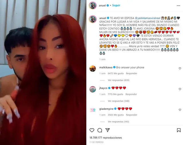 Anuel 